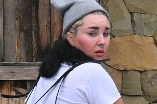 Amanda Bynes se pochlubila svým vzhledem po kosmetickém zákroku