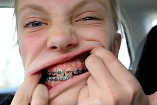 Nejsme kartel a ani nejdražší na světě, tvrdí čeští ortodontisté - zdravezpravy.cz