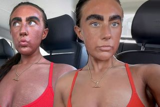 Mladá žena zůstala v šoku: Toto s ní udělalo 15 minut v soláriu - Super.cz