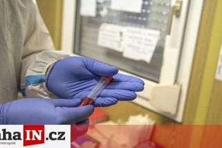 prahain.cz/zdravi/tri-manazeri-popsali-brutalni-prubeh-covidu-o-ockovani-nechteji-ani-slyset-20814.html