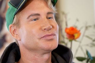 Český Ken šel pod kudlu na stejný zákrok jako Dara Rolins