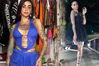 Tragédie na turecké klinice: Influencerka Ana B po liposukci a plastice nosu a prsou zemřela