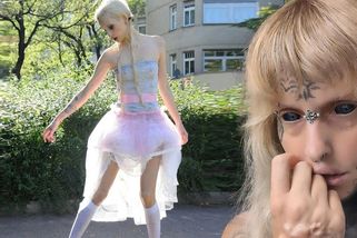 Němka s potetovaným bělmem se diví, že na ni všichni civí. Bývala přitom tak hezká