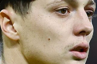 Roztržené oko, tvrdý pád. Krejčí zažil zápas plný bolesti - Sport.cz