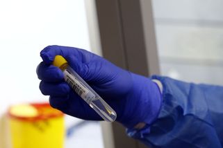 Slánská nemocnice hlásí „dosud nevídanou“ agresivitu šíření britské mutace - Novinky