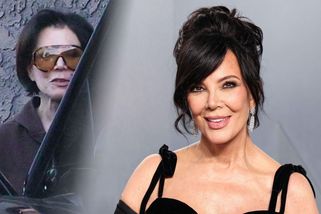 Není to Michael Jackson? Kris Jenner utratila za tvář miliony. Po roce jí padá