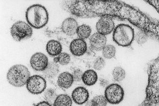 Na argentinský virus není vakcína ani léčba, ale pandemii experti nečekají - Novinky