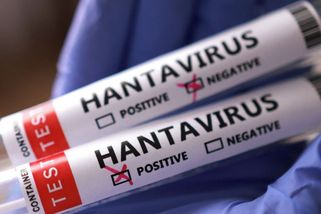V Izraeli se objevil hantavirus, ale jiný kmen než na výletní lodi - Novinky