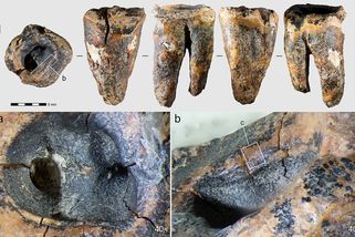 Prvním známým zubařem byl neandertálec z Ruska
