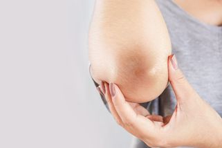 Zastavte diabetes dřív, než začne. Pozor na fibromy a tmavé skvrny!
