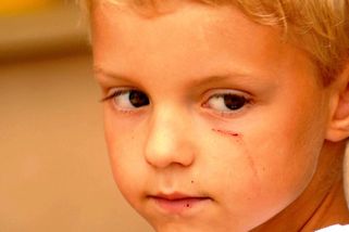 Dej mi cucnout! Chlapec se ve školce uklidnil máminým prsem. Učitelka jí vykázala ze školky - Médium.cz