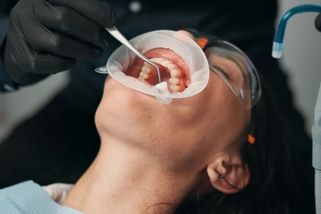 Stačí jedna návštěva u zubaře a vaše peněženka zapláče. Léčba chrupu se dnes snadno vyšplhá až ke 100 tisícům