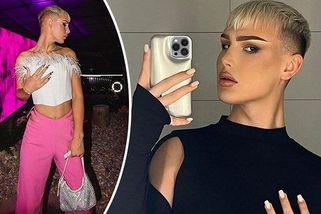 Nos, brada, pusa, obočí, čelo a lícní kosti. Český influencer Tadeáš Kuběnka přiznal plastiku i úpravy v obličeji - Super.cz