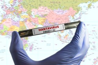 Smrtící hantavirus na výletní lodi? Číhá i u nás v kůlně nebo ve špajzu!