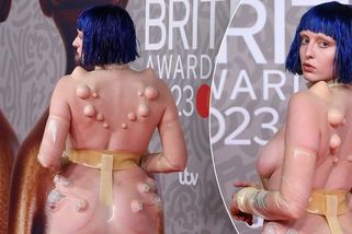 Zpěvačka Ashnikko na cenách BRIT šokovala v ‚nahém‘ modelu s boláky a boulemi po těle - Super.cz