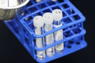 SZÚ k omikronu: Je to překvapivý virus, má vyšší riziko infekce - Novinky