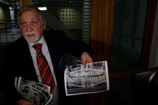 Pacient žaluje zubaře za údajně bezdůvodné vytržení 18 zubů. Stomatolog ho označuje za podvodníka - Novinky