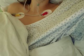 Hormonální antikoncepce: společensky uznávaný jed, který mě málem zabil - Médium.cz