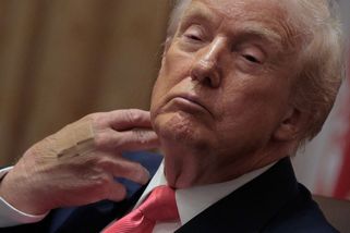 Strach o Donalda Trumpa. Oteklá tvář a problémy se sluchem nevěstí nic dobrého
