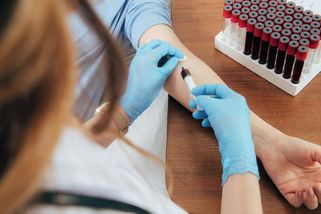 Testování od 10 let by mohlo snížit počet infarktů a mrtvic až o polovinu