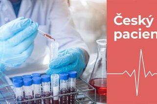 Naděje v boji s rakovinou. Léčba prochází převratnými změnami - Seznam Zprávy