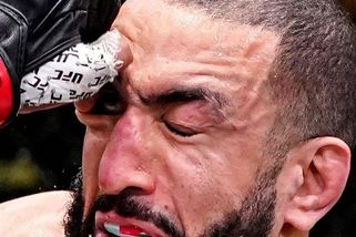 Hlavní zápas v UFC skončil brutálně. Potomkovi Palestinců stříkala krev z oka - Sport.cz