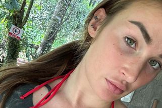 Další těžká infekce v těle! Pornoherečka v Ekvádoru chytila bakterii, která zabíjí - Super.cz