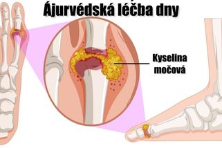 Ájurvédská medicína je EPICENTREM veškerých znalostí o léčení zvýšené hladiny kyseliny močové. Lékaři doporučují hlavně JEDNU potravinu