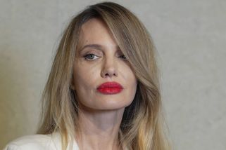 Co se stalo s tváří Angeliny Jolie? Je za tím nepovedený botox, plastika, nebo něco vážnějšího?