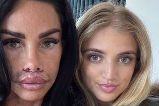 Katie Price způsobila dceři šok, když jí ukázala svou novou pusu