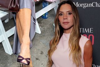 Co se jí stalo s nohama? Fanoušky vyděsila fotografie zdeformovaných chodidel Victorie Beckham