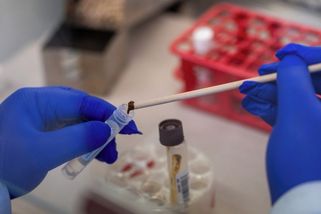Epidemie salmonely pokračuje, nakaženo je i šest Čechů. Zdrojem jsou zřejmě instantní nudle - Novinky