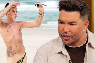 Dřív nosil nejúchylnější plavky, co jste kdy viděli. Nyní propadl plastické chirurgii a takhle dopad