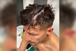 Deset stehů na hlavě. Klokani ukázali, jak dopadl Pilař po drsném zákroku slávisty N’Guessana