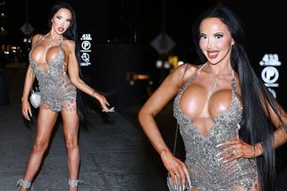 Americká modelka za plastiky utratila miliony: Takhle dnes vypadá dáma, které se prý muži bojí, protože je příliš krásná - Super.cz