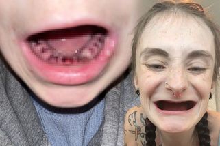 Ve dvaadvaceti přišla kvůli nedostatku vitamínů o všechny zuby. Vypadáš na 75! Trolí ji na internetu