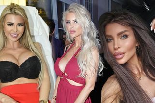 Obří rty, pikantní fotky i extrémní plastiky! Lela Vémola byla před lety k nepoznání