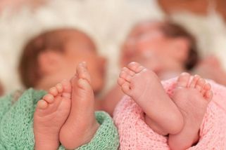 Slovenská siamská dvojčata narozená v červnu oddělí lékaři v Saudské Arábii