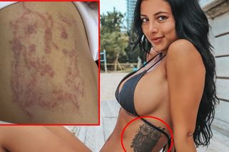 Tahle sovička vyšla sexy fitnesku hodně draho! Její odstranění už ji stálo 300 tisíc i vztah s tátou