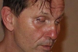Jaromír Soukup skončil po brutálním útoku v nemocnici. Maskovaní útočníci ho měli napadnout baseballovou pálkou