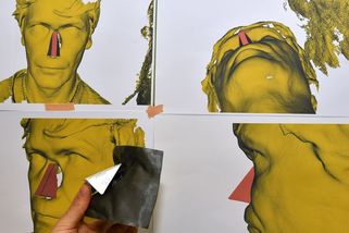 Muž kvůli rakovině přišel o celý nos a měl v hlavě díru. Plastičtí chirurgové v Brně mu udělali nový - Novinky