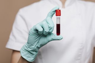 Rakovinu může odhalit dříve, než přijdou příznaky. Nový krevní test přijde na pár stovek