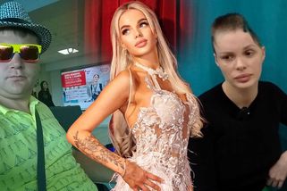 Milionář zbil modelku tak brutálně, že přišla o půlku lebky. Když se dozvěděl trest, z šoku zemřel