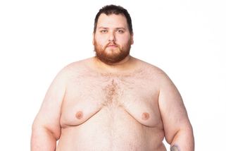 Morbidně obézní Marián váží děsivých 229 kilo! Takhle vypadá, když se svlékne