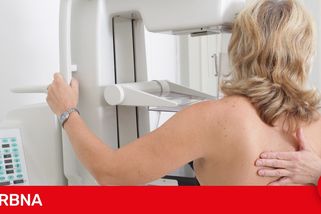 Od poloviny roku na mamograf bez žádanky. VZP klientkám zjednoduší přístup ke screeningu