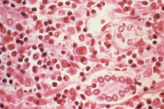 Po stopách pacientů nula. Epidemiologové hledají, kde se manželé nakazili smrtelným hantavirem - Novinky