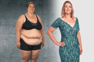 Soňa z Extrémních proměn zhubla 60 kilo a neskutečně prokoukla