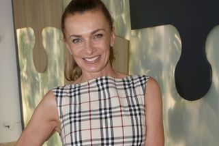 Co se stalo s Alicí Bendovou? Fanoušci spekulují, zda je za tím facelift, nebo operace zubů