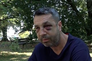 Přeražený nos a zlomená očnice: Surové napadení natočila bezpečnostní kamera