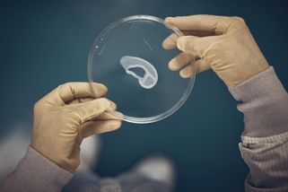 National Geographic | Může opotřebovaná chrupavka skutečně dorůst zpět? Vědci říkají, že ano, a mění tím léčbu artrózy